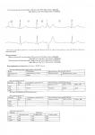 Расшифровка суточного мониторинга ЭКГ и рекомендации фото 2