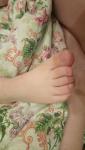 Шероховатости на ногтях ребенка фото 3