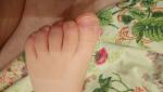 Шероховатости на ногтях ребенка фото 2