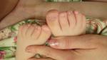 Шероховатости на ногтях ребенка фото 1