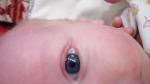 Белая непрозрачная пленка в глазу у новорожденного фото 2