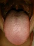 Припух язык фото 1