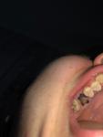 Чёрный зуб и боли фото 1