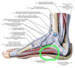 Боль в области стопы, продолжительная фото 1