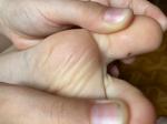 Черное пятнышко на пальце у ребенка фото 3