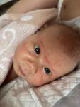Высыпания на лице новорождённого ребёнка фото 2