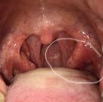 Воспаление полости рта фото 1