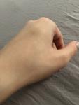 Шишка на кисти руки, болезненность при нажатии фото 1