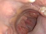 Колющая боль в горле фото 2