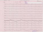 Есть ли какие-либо изменения в ЭКГ. фото 1