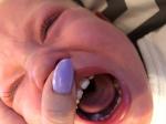 Пятна на зубах у ребёнка фото 1