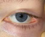 Болит внутренний угол глаза фото 1
