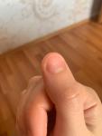 Изменения ногтей пластины фото 2