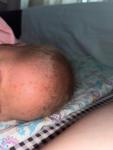 Высыпания на лице новорождённого ребёнка фото 3