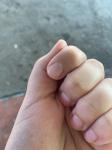 Коричневая полоса на ногте указательного пальца фото 1