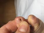 Пятно на ногте, гематома или нет, помогите разобраться, пож-та фото 2
