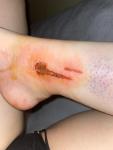 Сильно срезала кожу во время бриться ног фото 1
