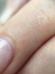 Раздражение/трещинки на сгибах пальцев рук фото 4