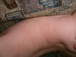 Разные пятна на теле у грудного ребенка фото 3