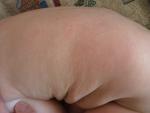 Сухие пятна разного размера у грудного ребенка фото 5