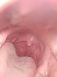 Периодически болит горло, пятна на горле фото 1