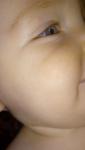 Розовые пятна у ребенка на теле и щеке фото 1