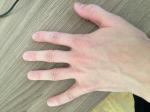Постоянные боли в пальцах рук (кончики пальцев) фото 3