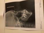 Боль в челюсти с правой стороны фото 2
