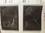 Дискинезия желчного протока фото 2