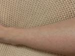 Мелкая сыпь на коже ног фото 1