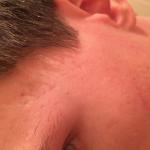 Появилась как красная сыпь фото 3