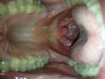 Воспаление горла, першение в горле фото 2