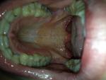 Воспаление горла, першение в горле фото 3