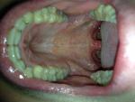 Воспаление горла, першение в горле фото 4
