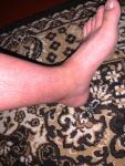 Красные пятна на икрах ног без чесания фото 3