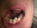 Кривой зуб фото 1