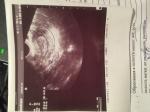 Нарушение менструального цикла, задержка месячных, не беременна фото 2