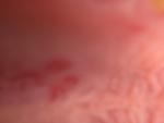 Красные пятна на нёбе после травмы фото 1
