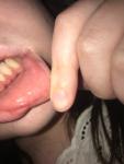 Пузырёк на слизистой губы фото 2