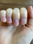 Ногти после родов фото 1