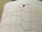 При диспансеризации сделали экг, но не расшифровали, помогите фото 2