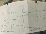 При диспансеризации сделали экг, но не расшифровали, помогите фото 3