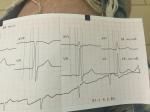 При диспансеризации сделали экг, но не расшифровали, помогите фото 4
