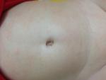 Сыпь и сухие пятна у грудного ребёнка +фото фото 3