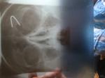 Рентген носовых пазух (ЛОР) фото 1