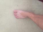 Боль в ступнях ног фото 2