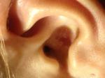 Язвочка в ушной раковине, темно-красного цвета, болезненна при нажатии фото 1