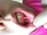 Странное пятно на нижней губе фото 1
