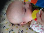 Красные Высыпание на лице у ребёнка фото 2