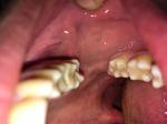 Проблемы в области слизистой рта и глотки фото 2